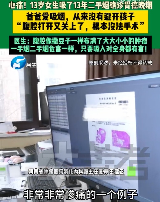 13岁女孩确诊胃癌晚期!爸爸常年吸烟从不避开孩子…医生提醒 13岁女孩确诊胃癌晚期!爸爸常年吸烟从不避开孩子…医生提醒