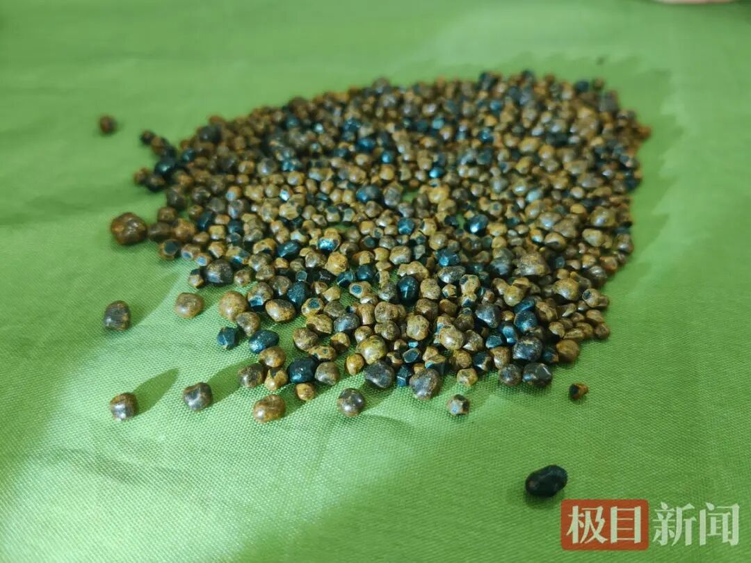 35岁男子胆囊被1000多颗结石塞满,医生提醒:切莫硬扛 35岁男子胆囊被1000多颗结石塞满,医生提醒:切莫硬扛