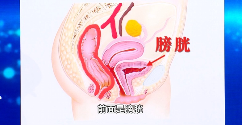 一种会装成“肠胃病”的癌，70%的人查出即晚期，很多人中招了还不知道