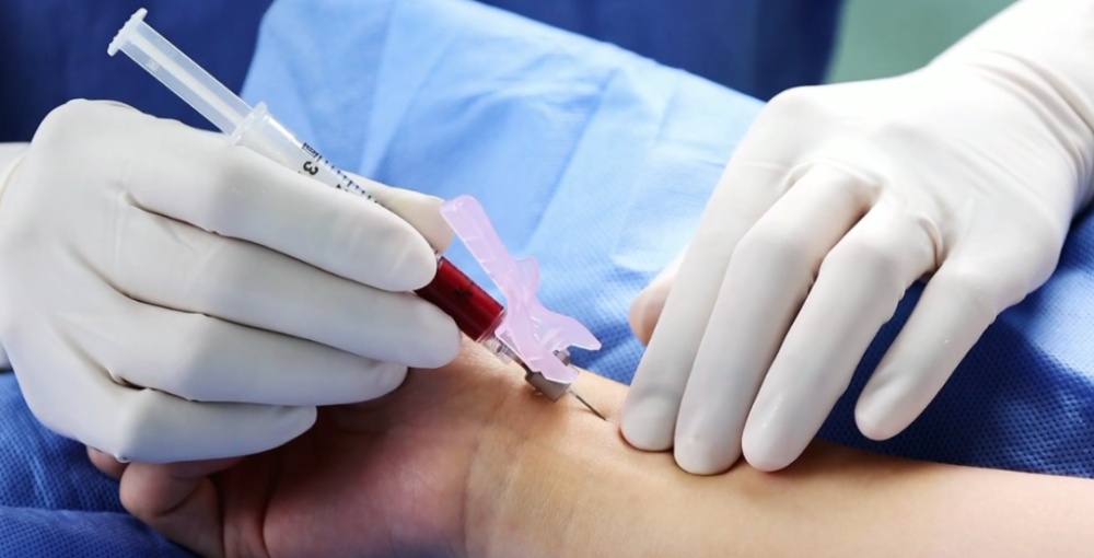 抽血不扎胳膊?为什么在手腕找来找去? 抽血不扎胳膊?为什么在手腕找来找去?