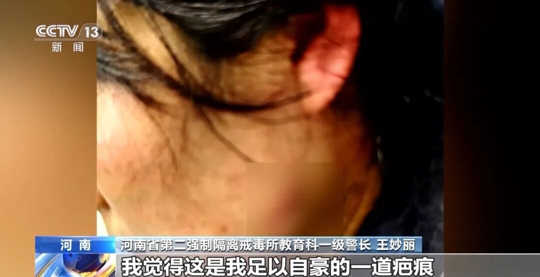 河南徒手夺刀女警被授一级英模，脸上缝30多针，本人：这是我足以自豪的一道疤痕！