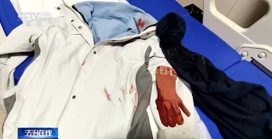 河南徒手夺刀女警被授一级英模，脸上缝30多针，本人：这是我足以自豪的一道疤痕！