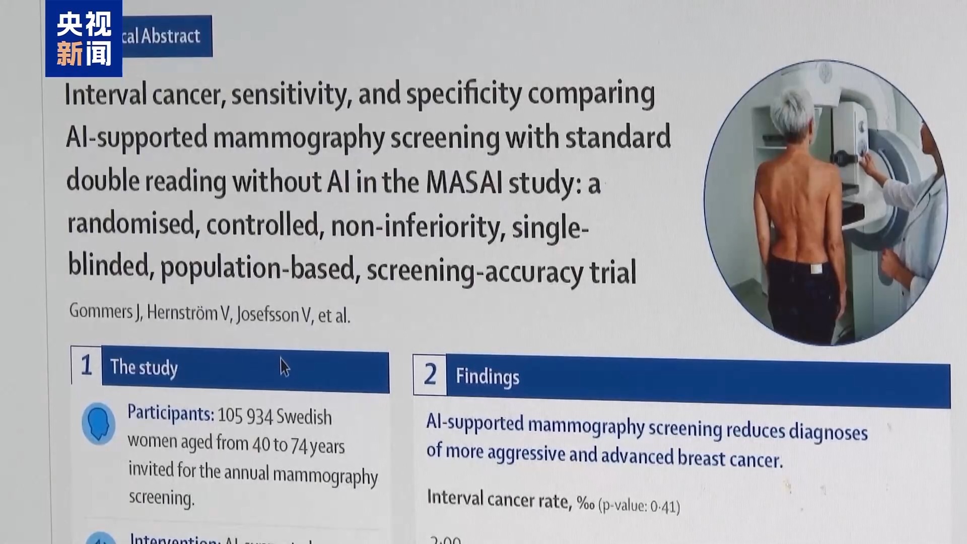 最新研究显示 AI辅助乳腺筛查可降低“间期癌”发病率
