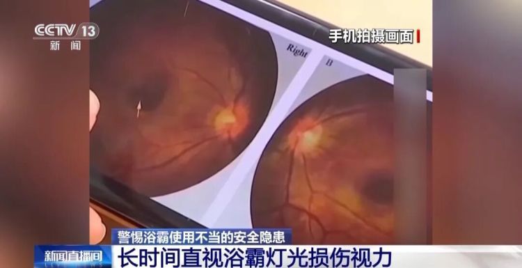 突然起火、损伤视力，冬季洗澡不要这样使用浴霸！