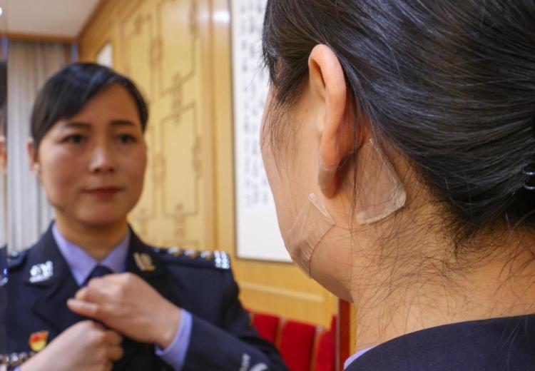 徒手夺刀制止行凶 脸上缝合30多针!河南司法行政戒毒女警王妙丽被表彰 徒手夺刀制止行凶 脸上缝合30多针!河南司法行政戒毒女警王妙丽被表彰