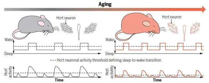 3个变老表现，从睡觉开始！如果一个都不占，证明你还年轻！