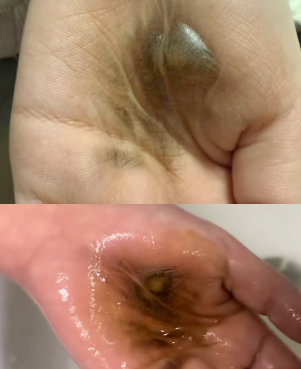 正吹着头发,吹风机竟突然爆炸! 正吹着头发,吹风机竟突然爆炸!