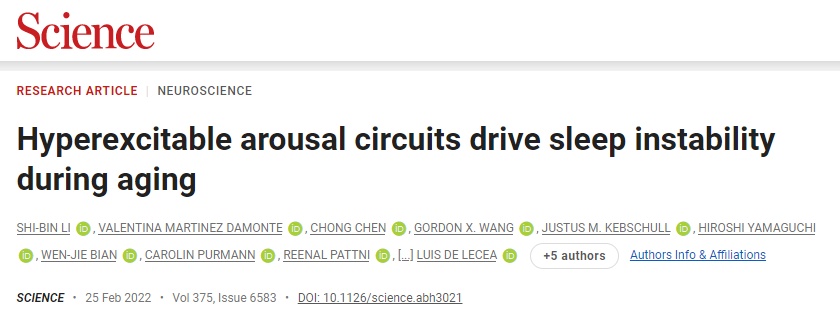 3个变老表现，从睡觉开始！如果一个都不占，证明你还年轻！