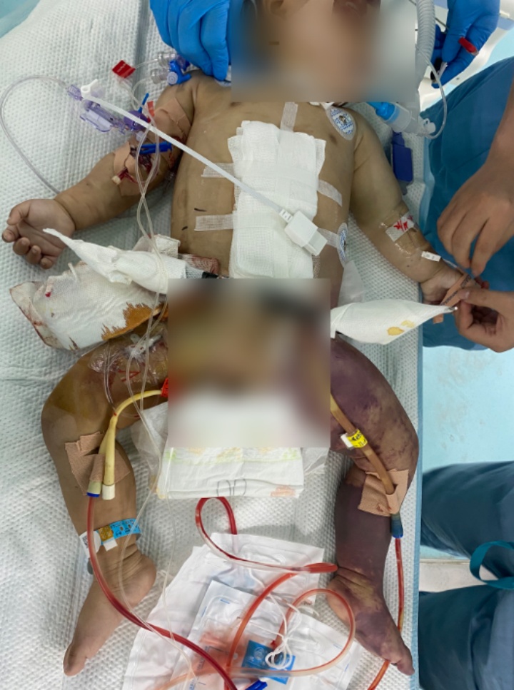 电瓶车被撞，母亲“背上”的一岁孩子遭“甩出”！医生：截肢，部分骨盆离断！