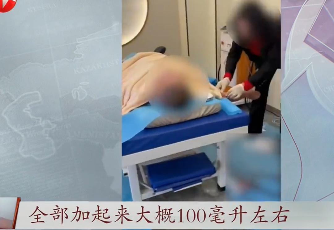 触目惊心！长针刺入皮肤，黑诊所血流满地，操作者却说在“排邪气”