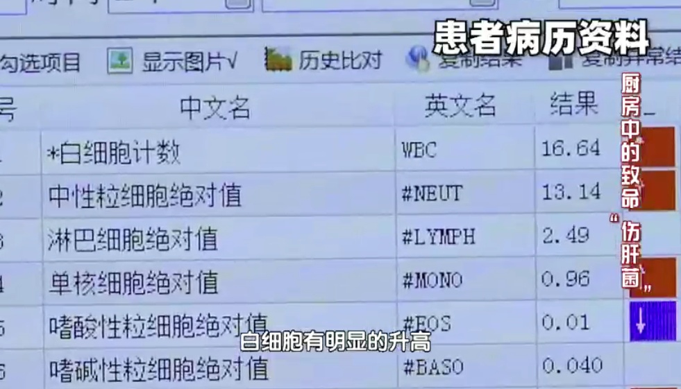 血常规这几项有“箭头”,癌症可能已经上身了 血常规这几项有“箭头”,癌症可能已经上身了