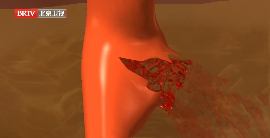 血常规这几项有“箭头”,癌症可能已经上身了 血常规这几项有“箭头”,癌症可能已经上身了