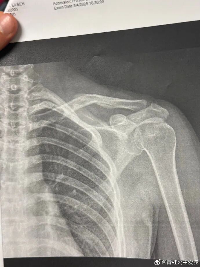 谷爱凌，拿下中国冬奥军团第一银