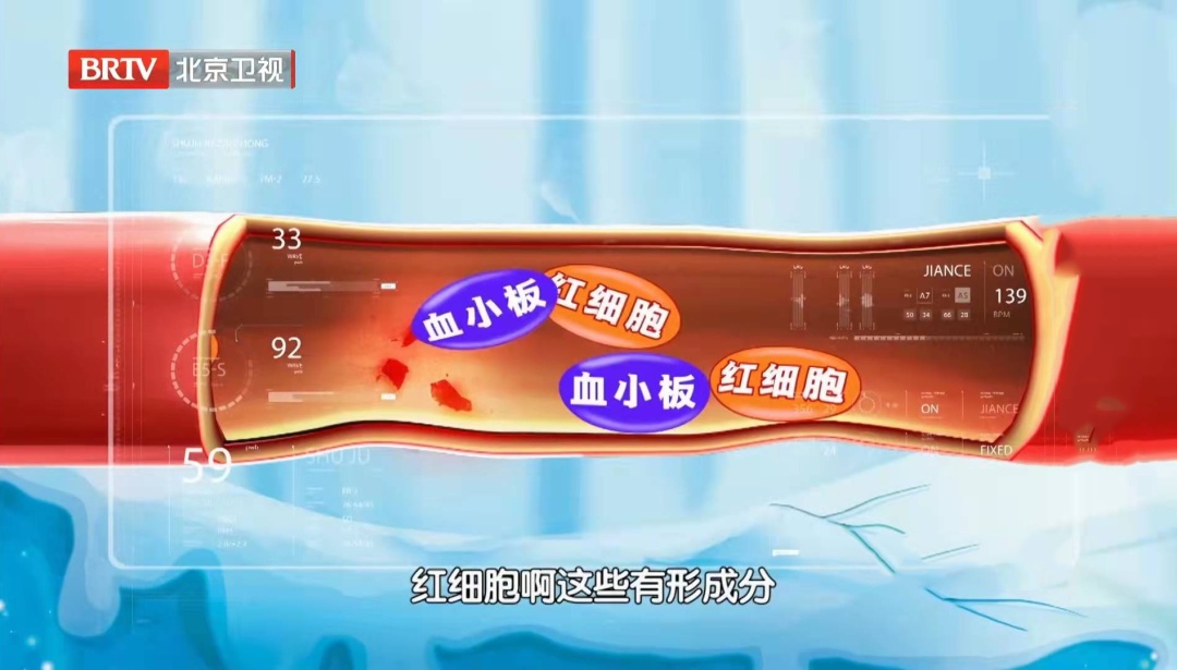 血常规这几项有“箭头”,癌症可能已经上身了 血常规这几项有“箭头”,癌症可能已经上身了