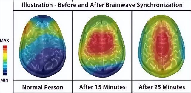 一个能拯救大脑的“邪修恢复术”,只需 10 分钟,真的很有效!!! 一个能拯救大脑的“邪修恢复术”,只需 10 分钟,真的很有效!!!