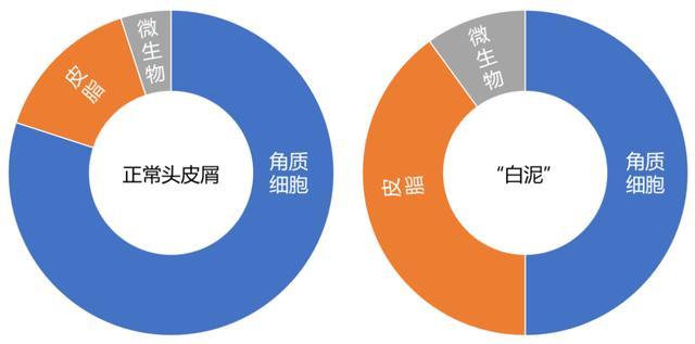 救命!头皮上抠出来的“白泥”到底是啥?会把头抠秃吗? 救命!头皮上抠出来的“白泥”到底是啥?会把头抠秃吗?