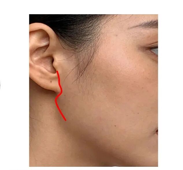 女子磕到下巴导致面部骨折！医生在“嘴里”给她做手术