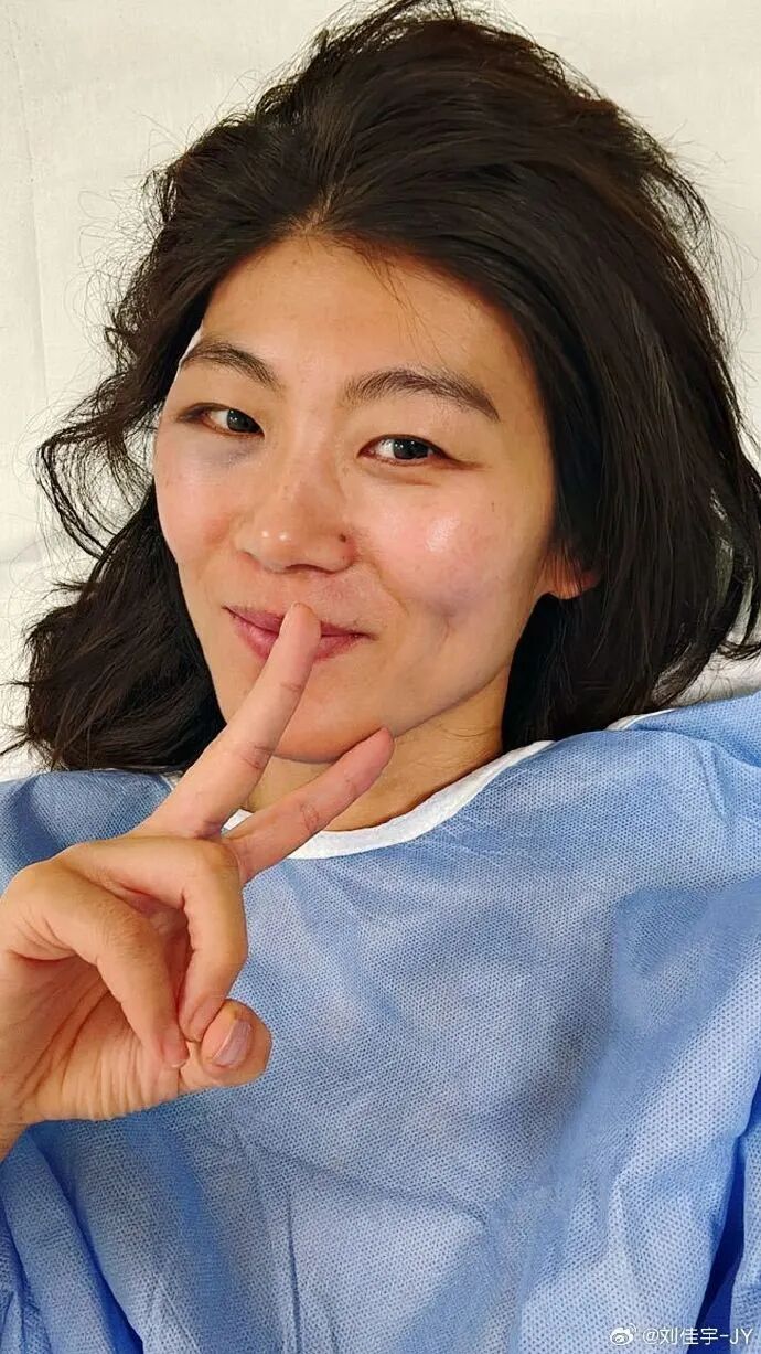 头部冲下摔倒,额头缝了一针……刘佳宇发文:一切安好 头部冲下摔倒,额头缝了一针……刘佳宇发文:一切安好