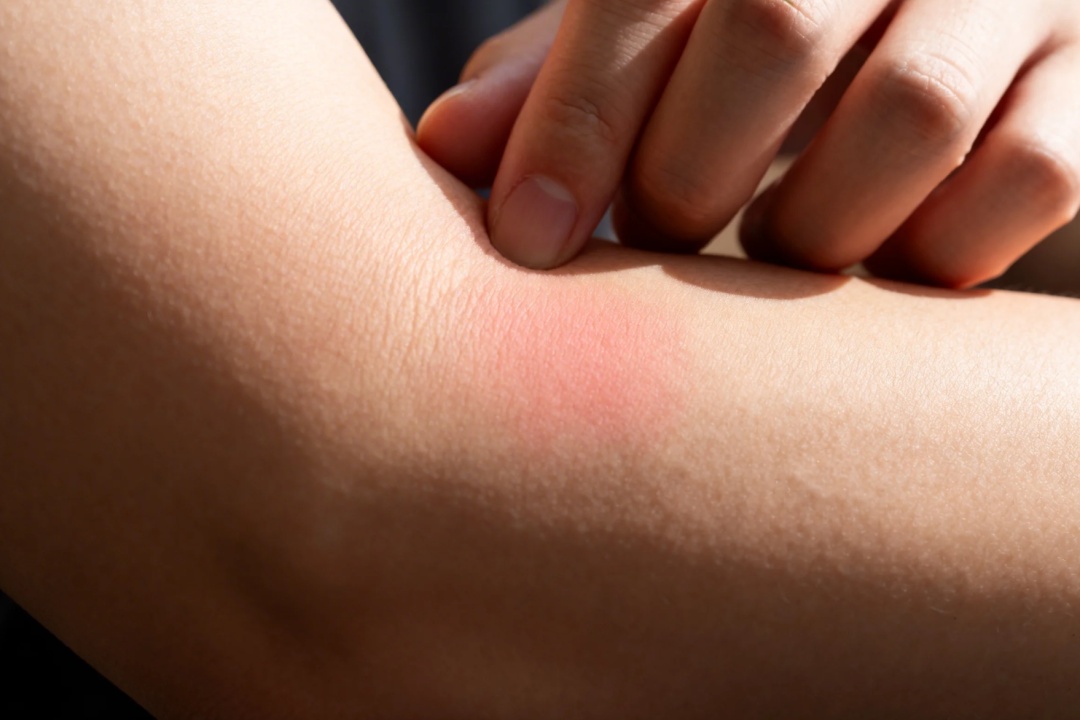 这些身体信号是血管在“求救”！3个护血管方法，赶紧收藏！