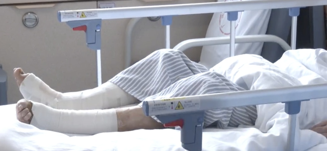 九旬老人左脚成“黑蹄子”，原来是下肢动脉闭塞导致……