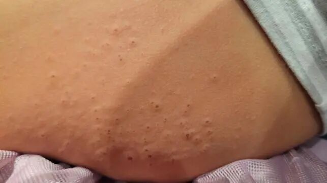 重要提醒！广东人过年“洗邋遢”，用这“神器”要注意→