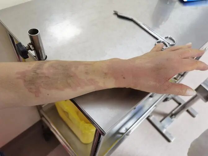 重要提醒！广东人过年“洗邋遢”，用这“神器”要注意→