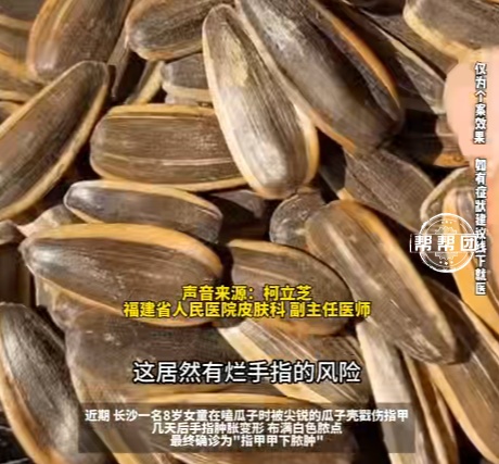 8岁女童被瓜子壳刺伤，竟导致甲下化脓手指变形！医生提醒