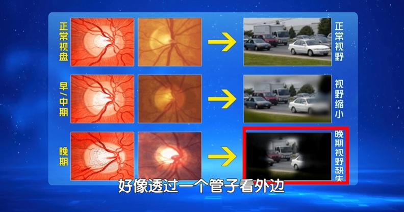 这件睁眼就做的事可能正悄悄“腐蚀”大脑，越做越傻！4个方法自救