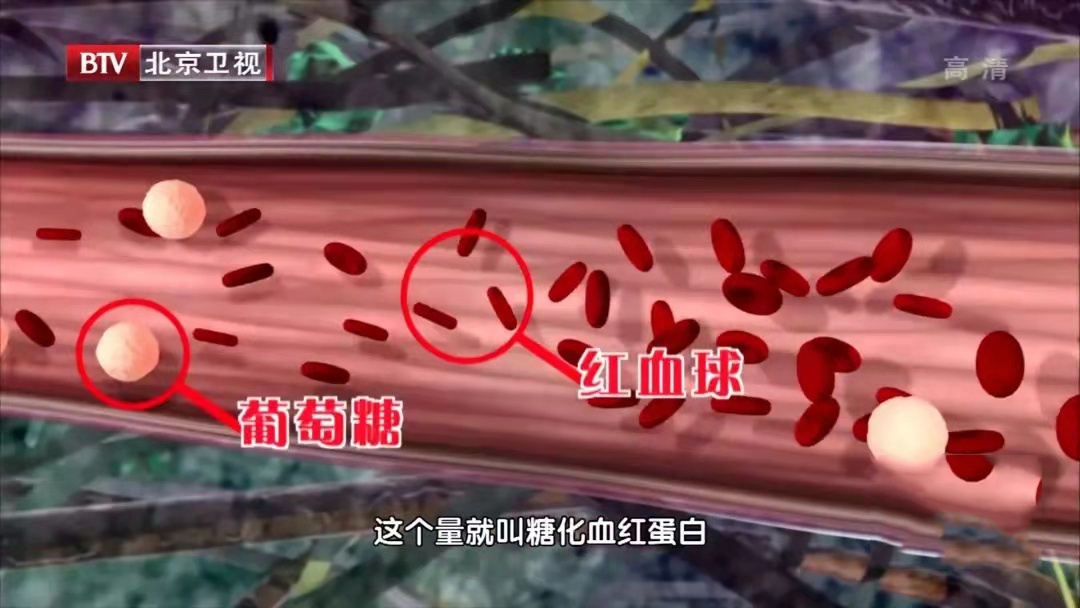 体检单上这5个“隐性指标”,比血糖重要得多,但很多人都忽视了 体检单上这5个“隐性指标”,比血糖重要得多,但很多人都忽视了