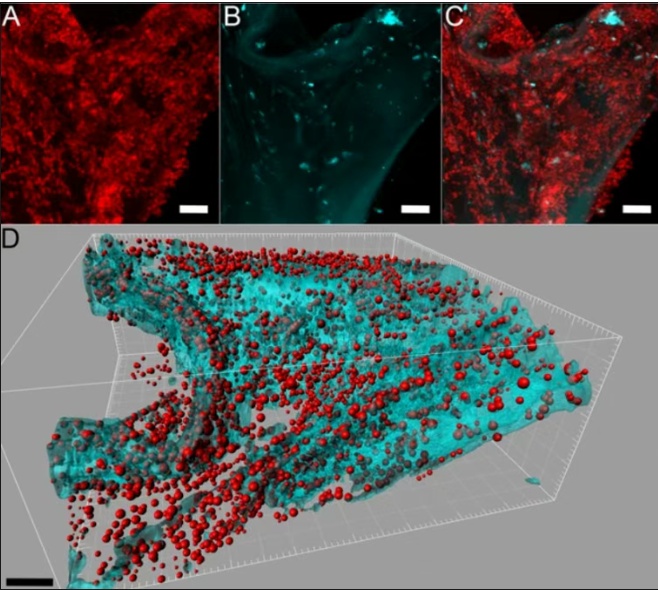 你“最信任”的清洁工具可能是细菌发源地 一文揭秘 你“最信任”的清洁工具可能是细菌发源地 一文揭秘