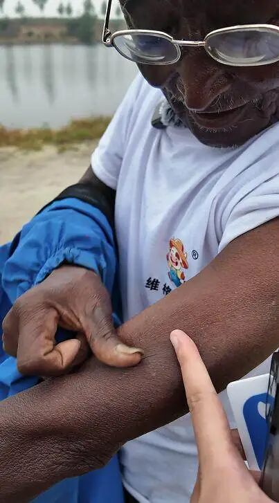 因一身黝黑皮肤走红，“八级钓帝”河北唐山七旬大爷安国勇因病去世，享年75岁