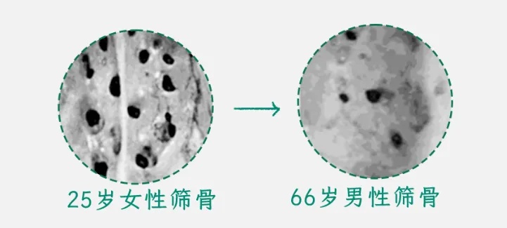 如果最近突然爱上吃这两样东西，说明你的身体确实老了