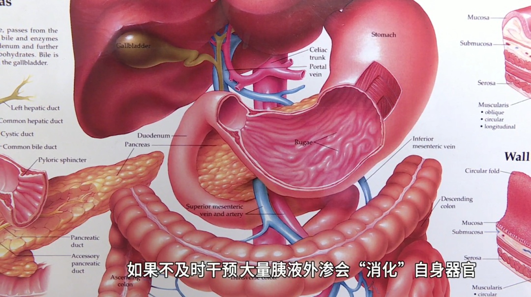 听劝!千万别再这样吃了,真的会把你的胰腺“搞垮” 听劝!千万别再这样吃了,真的会把你的胰腺“搞垮”