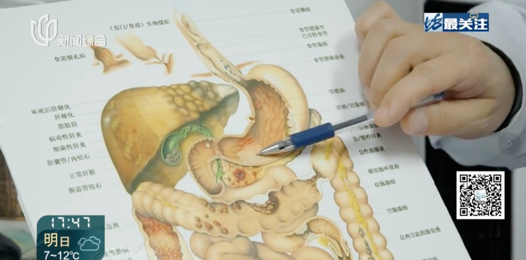 瑞金医生紧急提醒!有人连夜赶回上海,有人9天假期住院7天… 瑞金医生紧急提醒!有人连夜赶回上海,有人9天假期住院7天…