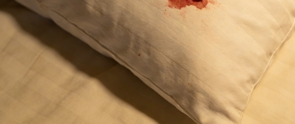 12岁女孩半夜枕头有血!近期多发,诱因就在家中,浙江很多人离不开它 12岁女孩半夜枕头有血!近期多发,诱因就在家中,浙江很多人离不开它