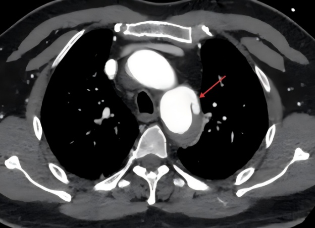 “疼死我了……”深夜男子血管“撕裂”，被紧急送进抢救室