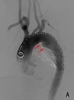 “疼死我了……”深夜男子血管“撕裂”，被紧急送进抢救室