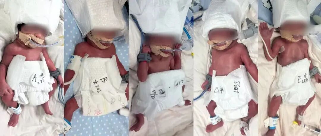 六千万分之一概率！24岁女子成功产下1男4女五胞胎