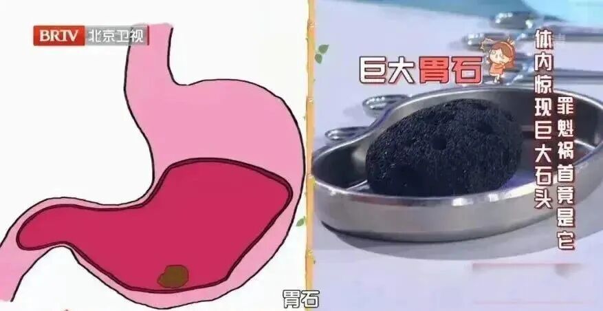 蓝莓越大，营养可能越“缩水”，90%的人都吃错了