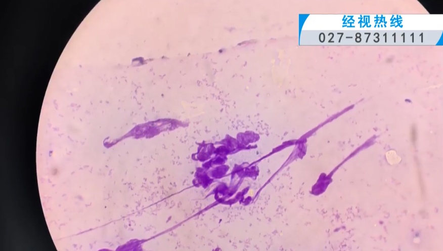 女子亲密撸鹦鹉,眼睛意外长出“小东西”!医生提醒 女子亲密撸鹦鹉,眼睛意外长出“小东西”!医生提醒