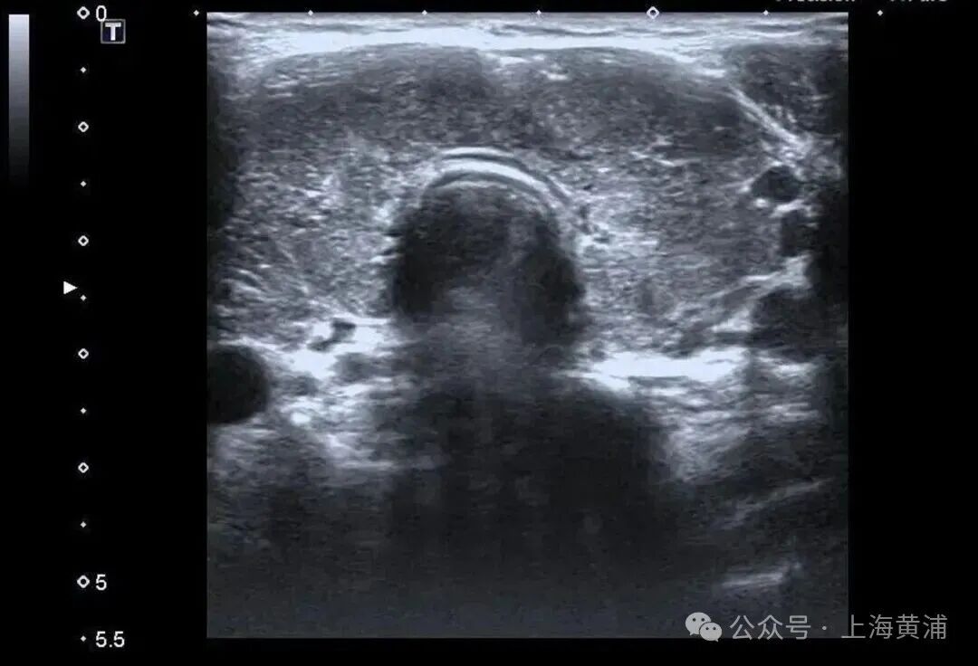 32岁女子突然不对劲,心脏、肝脏等器官全部罢工!想想就后怕 32岁女子突然不对劲,心脏、肝脏等器官全部罢工!想想就后怕