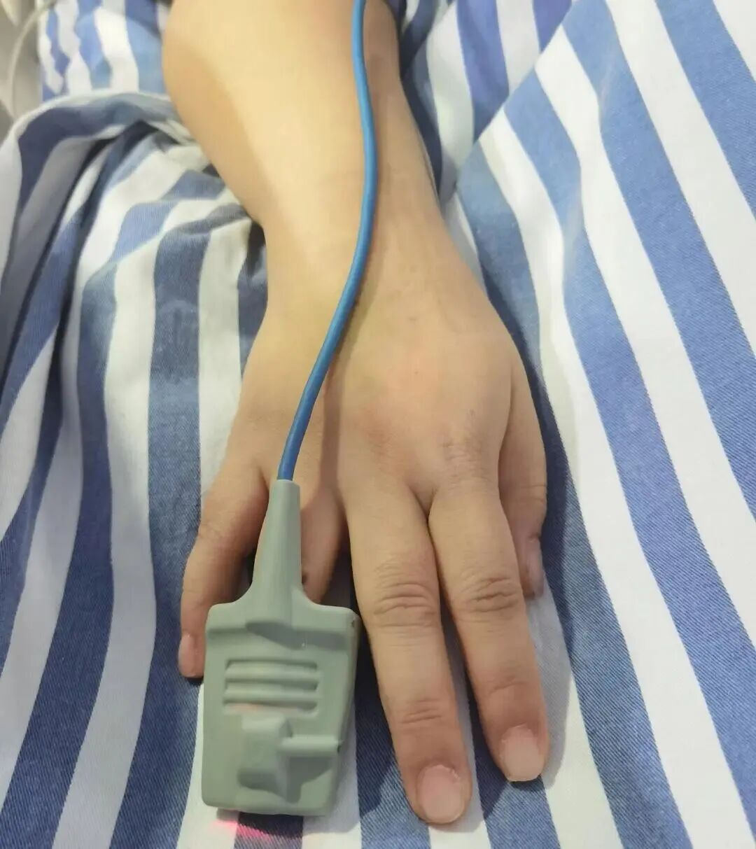 女子心跳骤停,却因美甲无法抢救!医生:做美甲要留一个“救命指” 女子心跳骤停,却因美甲无法抢救!医生:做美甲要留一个“救命指”