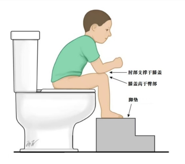 儿童正确的排便姿势