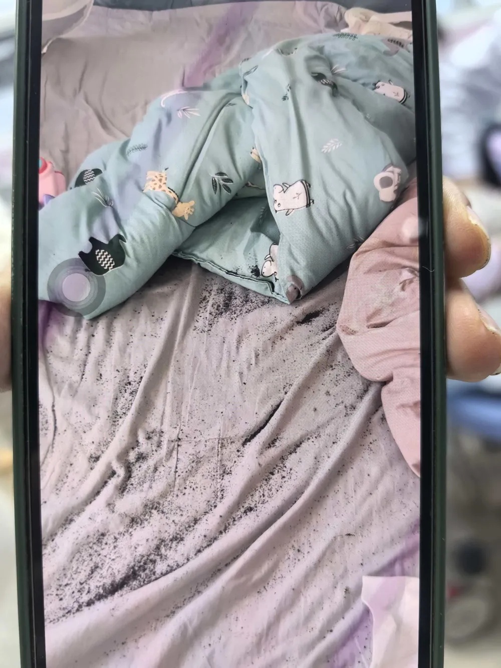 杭州13个月宝宝误触爸爸脚气药粉,头、面部严重灼伤,医生提醒 杭州13个月宝宝误触爸爸脚气药粉,头、面部严重灼伤,医生提醒