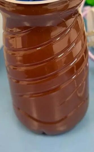 这种饮食习惯危险!女子感染寄生虫多年未治疗 20多年来越吃越瘦 这种饮食习惯危险!女子感染寄生虫多年未治疗 20多年来越吃越瘦