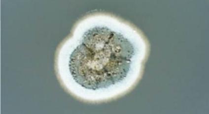 扔了可惜吃了害怕 水果烂了一小块到底还能不能吃？