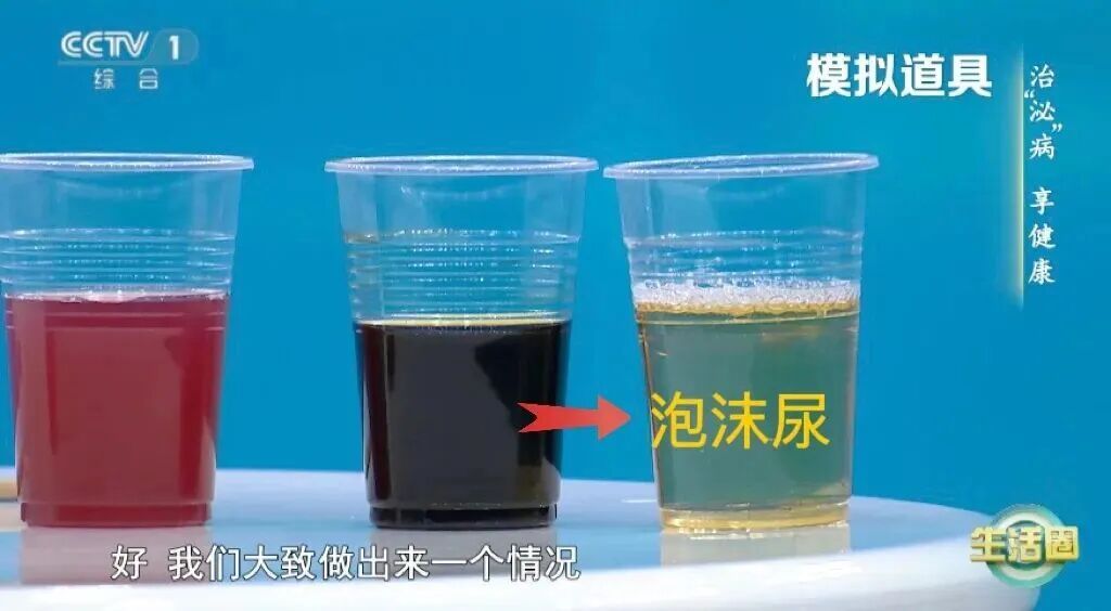 人体自带“血糖仪”,这5个变化提示你,血糖可能失控了! 人体自带“血糖仪”,这5个变化提示你,血糖可能失控了!