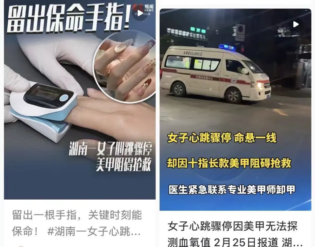 抢救室里,“医生叫来美甲师”?特别提醒:给自己留一个“救命指” 抢救室里,“医生叫来美甲师”?特别提醒:给自己留一个“救命指”