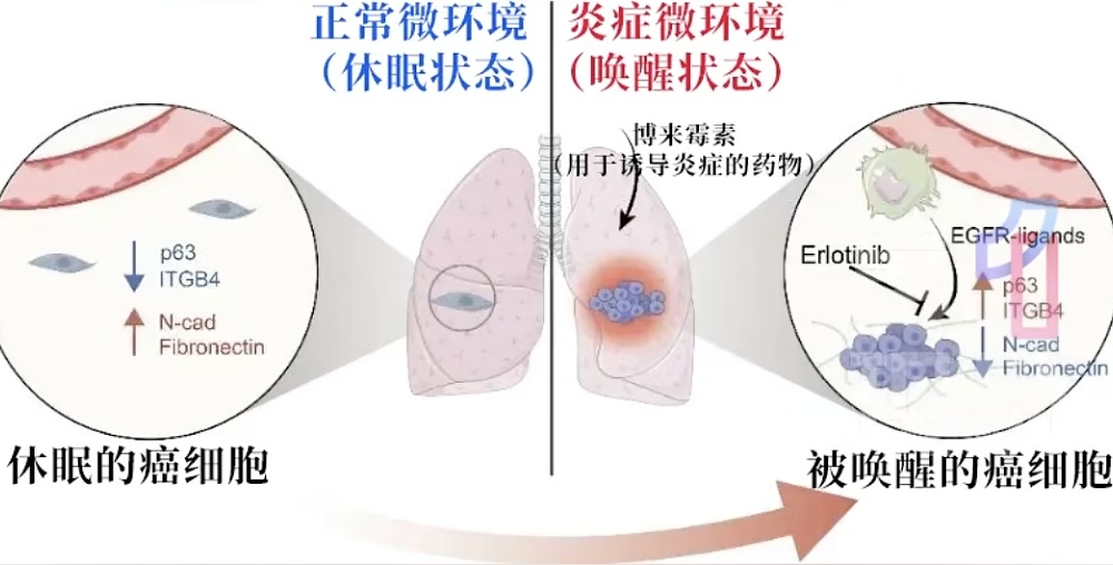 长期炎症会”唤醒“癌细胞! 出现这些症状要当心, 这份抗炎指南请收好 长期炎症会”唤醒“癌细胞! 出现这些症状要当心, 这份抗炎指南请收好