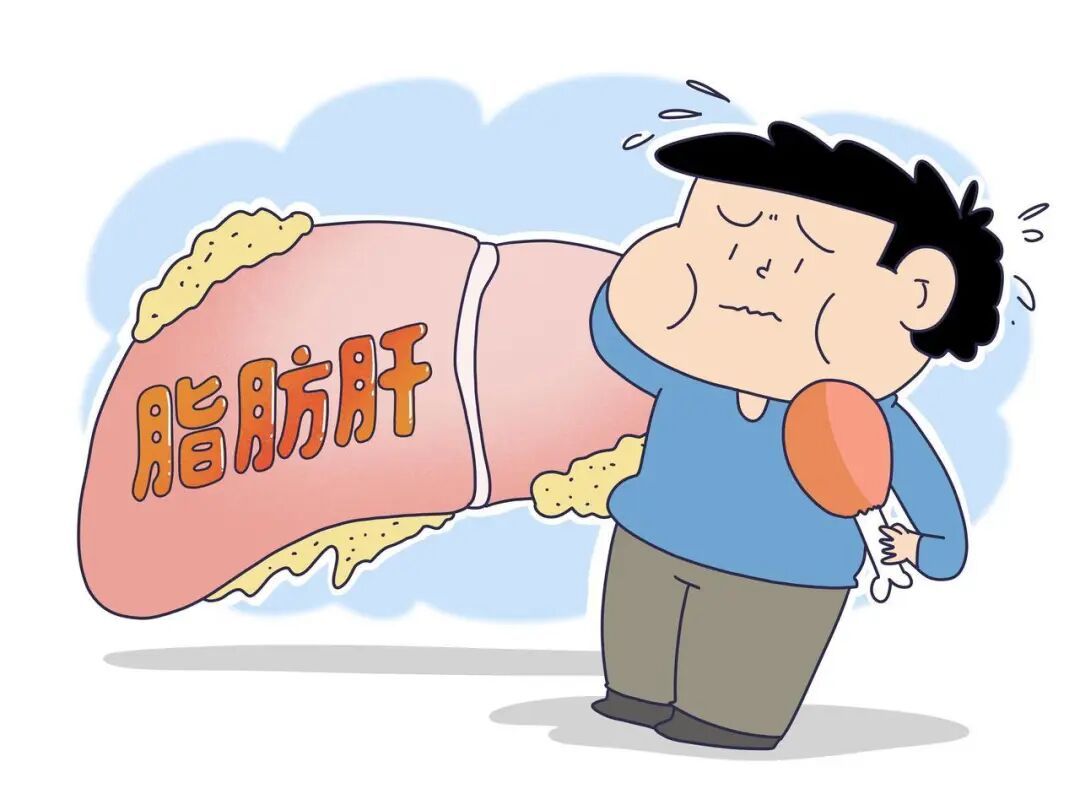 脂肪肝:呈年轻化趋势,且瘦人也可能患上! 脂肪肝:呈年轻化趋势,且瘦人也可能患上!